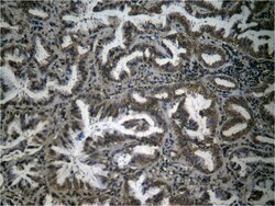 Invitrogen Phospho-NFkB p65 (Ser276) Polyclonal Antibody 100 &mu;L | Buy Online | Invitrogen&trade; | Fisher Scientific