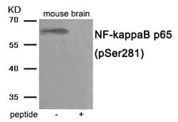 Invitrogen Phospho-NFkB p65 (Ser281) Polyclonal Antibody 100 &mu;L; Unconjugated:Antibodies,