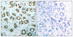 Invitrogen Phospho-NFkB p65 (Ser311) Polyclonal Antibody 100 &mu;L; Unconjugated:Antibodies,