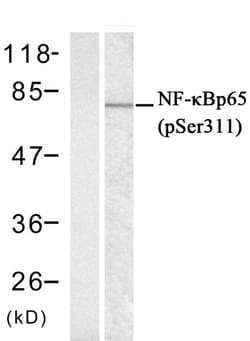 Invitrogen Phospho-NFkB p65 (Ser311) Polyclonal Antibody 100 &mu;L; Unconjugated:Antibodies,