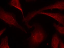 Phospho-NFkB p65 (Ser529) Polyclonal Antibody:Antibodies, Polyclonal