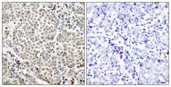 Phospho-NFkB p65 (Ser529) Polyclonal Antibody:Antibodies, Polyclonal