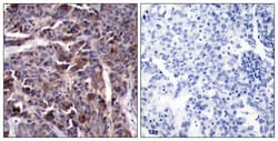 Phospho-NFkB p65 (Thr505) Polyclonal Antibody:Antibodies, Polyclonal