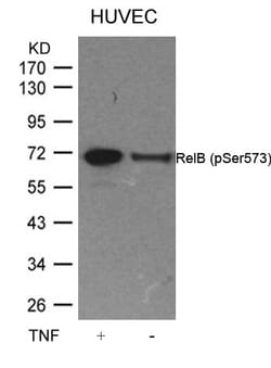 Invitrogen Phospho-RelB (Ser573) Polyclonal Antibody 100 &mu;L; Unconjugated:Antibodies,