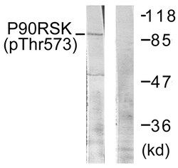 Invitrogen Phospho-RSK1 (Thr573) Polyclonal Antibody 100 &mu;L | Buy Online | Invitrogen&trade; | Fisher Scientific