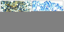 Phospho-p70 S6 Kinase (Ser411) Polyclonal Antibody, Invitrogen 100 &mu;L;