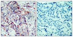 Invitrogen Phospho-MAP2K4 (Ser80) Polyclonal Antibody 100 &mu;L; Unconjugated:Antibodies,