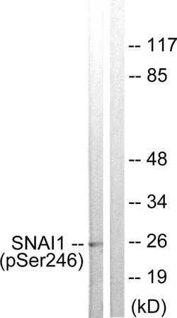 Invitrogen Phospho-SNAIL (Ser246) Polyclonal Antibody 100 &mu;L | Buy Online | Invitrogen&trade; | Fisher Scientific