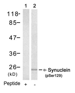 Invitrogen Phospho-alpha Synuclein (Ser129) Polyclonal Antibody 100 &mu;L;