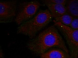 Phospho-alpha Synuclein (Tyr125) Polyclonal Antibody:Antibodies, Polyclonal