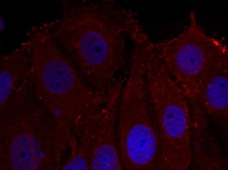 Invitrogen Phospho-alpha Synuclein (Tyr133) Polyclonal Antibody 100 &mu;L;
