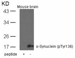 Invitrogen Phospho-alpha Synuclein (Tyr136) Polyclonal Antibody 100 &mu;L | Buy Online | Invitrogen&trade; | Fisher Scientific