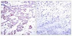 Invitrogen Phospho-STAT6 (Thr645) Polyclonal Antibody 100 &mu;L; Unconjugated:Antibodies,