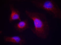 Invitrogen Phospho-Syk (Tyr323) Polyclonal Antibody 100 &mu;L; Unconjugated:Antibodies,