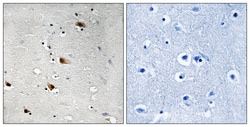 Invitrogen Phospho-TCF3 (Thr355) Polyclonal Antibody 100 &mu;L; Unconjugated:Antibodies,