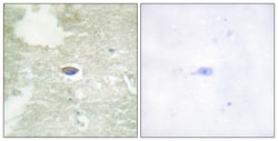 Invitrogen Phospho-TGFBR2 (Ser225, Ser250) Polyclonal Antibody 100 &mu;L;
