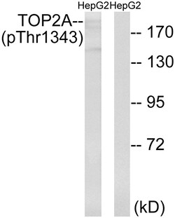 Invitrogen Phospho-TOP2A (Thr1343) Polyclonal Antibody 100 &mu;L | Buy Online | Invitrogen&trade; | Fisher Scientific