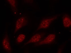 Invitrogen Phospho-p53 (Ser315) Polyclonal Antibody 100 &mu;L; Unconjugated:Antibodies,