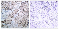 Invitrogen Phospho-p53 (Ser315) Polyclonal Antibody 100 &mu;L; Unconjugated:Antibodies,