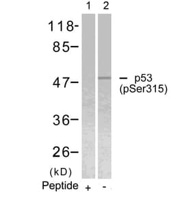 Invitrogen Phospho-p53 (Ser315) Polyclonal Antibody 100 &mu;L | Buy Online | Invitrogen&trade; | Fisher Scientific
