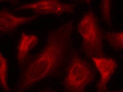 Invitrogen Phospho-p53 (Ser33) Polyclonal Antibody 100 &mu;L; Unconjugated:Antibodies,