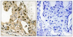 Invitrogen Phospho-p53 (Thr387) Polyclonal Antibody 100 &mu;L; Unconjugated:Antibodies,