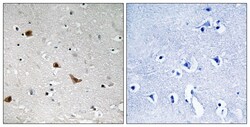 Invitrogen Phospho-IKK gamma (Ser376) Polyclonal Antibody 100 &mu;L; Unconjugated:Antibodies,