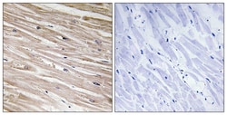 Invitrogen Phospho-PEA15 (Ser104) Polyclonal Antibody 100 μL; Unconjugated:Antibodies,