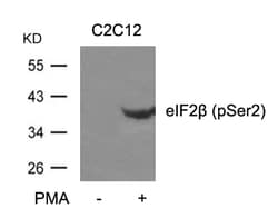 Invitrogen Phospho-eIF2 beta (Ser2) Polyclonal Antibody 100 &mu;L; Unconjugated:Antibodies,