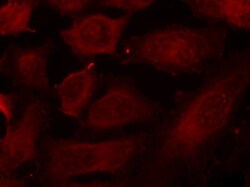 Invitrogen Phospho-DOK2 (Tyr299) Polyclonal Antibody 100 &mu;L | Buy Online | Invitrogen&trade; | Fisher Scientific