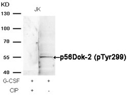 Invitrogen Phospho-DOK2 (Tyr299) Polyclonal Antibody 100 &mu;L | Buy Online | Invitrogen&trade; | Fisher Scientific