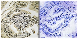 Invitrogen Phospho-PERK (Thr982) Polyclonal Antibody 100 &mu;L; Unconjugated:Antibodies,