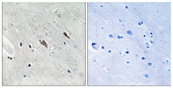Invitrogen Phospho-GAB2 (Tyr643) Polyclonal Antibody 100 &mu;L; Unconjugated:Antibodies,