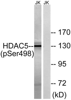Invitrogen Phospho-HDAC5 (Ser498) Polyclonal Antibody 100 &mu;L; Unconjugated:Antibodies,