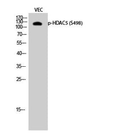 Invitrogen Phospho-HDAC5 (Ser498) Polyclonal Antibody 100 &mu;L; Unconjugated:Antibodies,