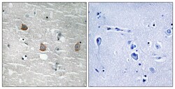 Invitrogen Phospho-TOB1 (Ser164) Polyclonal Antibody 100 &mu;L; Unconjugated:Antibodies,