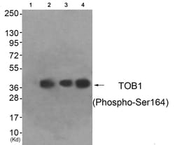 Invitrogen Phospho-TOB1 (Ser164) Polyclonal Antibody 100 &mu;L; Unconjugated:Antibodies,