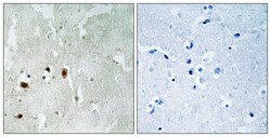 Invitrogen Phospho-TIP60 (Ser90) Polyclonal Antibody 100 &mu;L; Unconjugated:Antibodies,