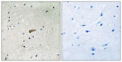 Invitrogen Phospho-FRS2 (Tyr436) Polyclonal Antibody 100 &mu;L; Unconjugated:Antibodies,