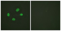 Phospho-CHK2 (Thr383) Polyclonal Antibody, Invitrogen 100 &mu;L; Unconjugated:Antibodies,