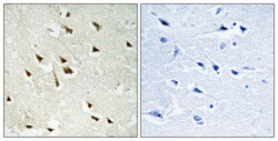 Invitrogen Phospho-GRF-1 (Tyr1105) Polyclonal Antibody 100 &mu;L; Unconjugated:Antibodies,