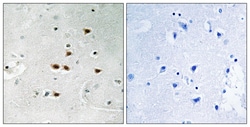 Invitrogen Phospho-ITCH (Tyr420) Polyclonal Antibody 100 &mu;L; Unconjugated:Antibodies,