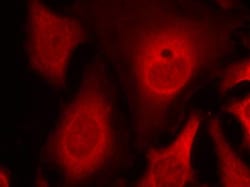 Invitrogen Phospho-EIF2S1 (Ser49) Polyclonal Antibody 100 &mu;L; Unconjugated:Antibodies,