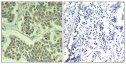 Invitrogen Phospho-EIF2S1 (Ser49) Polyclonal Antibody 100 &mu;L; Unconjugated:Antibodies,