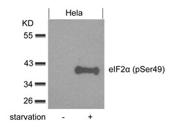 Invitrogen Phospho-EIF2S1 (Ser49) Polyclonal Antibody 100 &mu;L; Unconjugated:Antibodies,