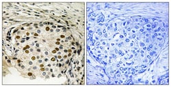 Phospho-OSR1 (Thr185) Polyclonal Antibody, Invitrogen 100 &mu;L; Unconjugated:Antibodies,