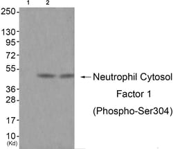 Invitrogen Phospho-p47phox (Ser304) Polyclonal Antibody 100 &mu;L; Unconjugated:Antibodies,