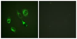 Invitrogen Phospho-EphA2/EphA3/EphA4 (Tyr588, Tyr596) Polyclonal Antibody