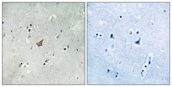 Invitrogen Phospho-EphA3/EphA4/EphA5 (Tyr779, Tyr833) Polyclonal Antibody