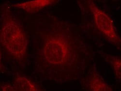 Invitrogen Phospho-AKT Pan (Tyr315, Tyr316, Tyr312) Polyclonal Antibody